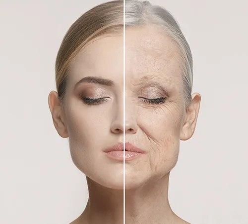 Laser Hair Removal Treatment